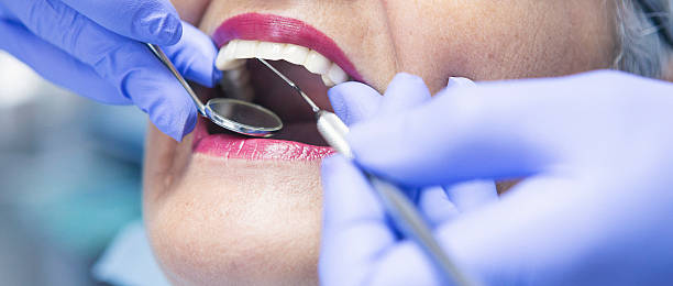 Best Broken or Chipped Tooth Repair in Milwaukee, WI